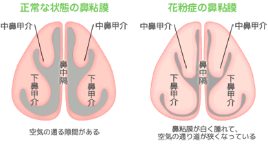 illust